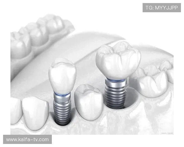 凯发集团手机登录下载安装流程全解析，确保每一步操作都顺畅无误